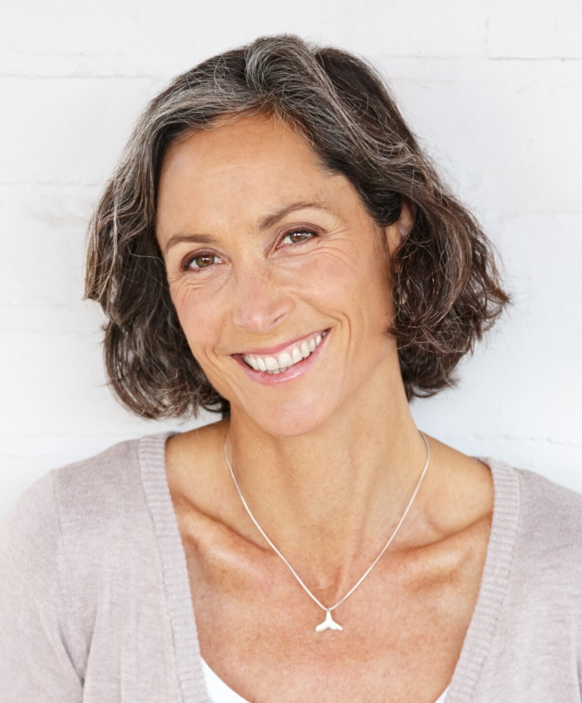 Detroit lower blepharoplasty model smiling